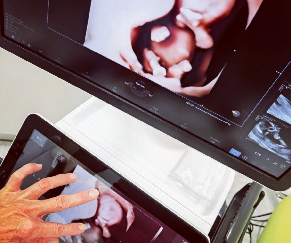 Ultrazvok za 3D/4D ultrazvočne preiskave