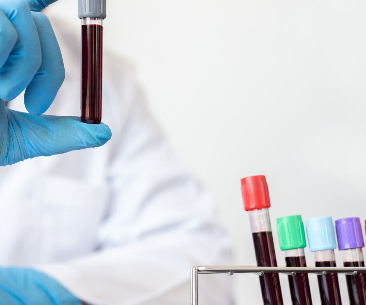 Laboratorijski testi krvi